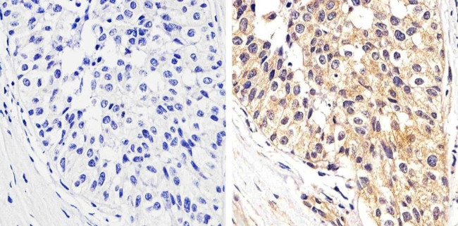 Phospho-STAT1 (Tyr701) Antibody in Immunohistochemistry (Paraffin) (IHC (P))