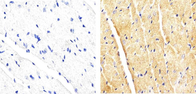 p38 MAPK beta Antibody in Immunohistochemistry (Paraffin) (IHC (P))