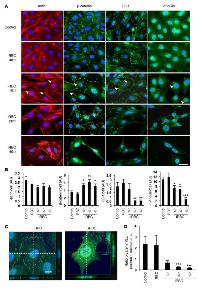 Vinculin Antibody in Immunocytochemistry (ICC/IF)