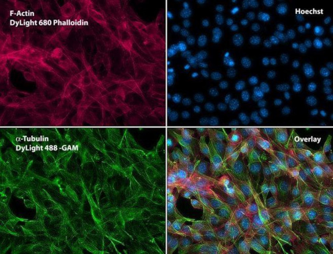 Mouse IgG (H+L) Secondary Antibody in Immunocytochemistry (ICC/IF)