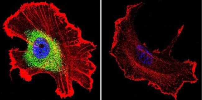 Mouse IgG (H+L) Cross-Adsorbed Secondary Antibody in Immunocytochemistry (ICC/IF)