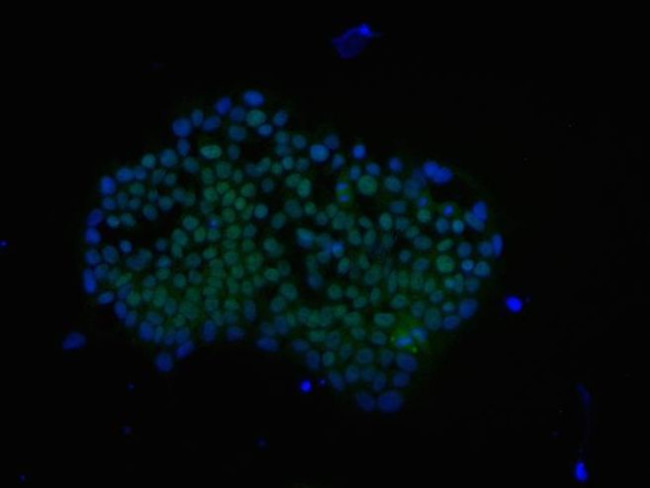 Rabbit IgG (H+L) Cross-Adsorbed Secondary Antibody in Immunocytochemistry (ICC/IF)