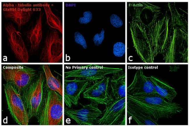 Rabbit IgG (H+L) Secondary Antibody in Immunocytochemistry (ICC/IF)