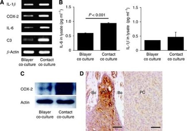 COX2 Antibody in Western Blot, Immunohistochemistry (Paraffin) (WB, IHC (P))