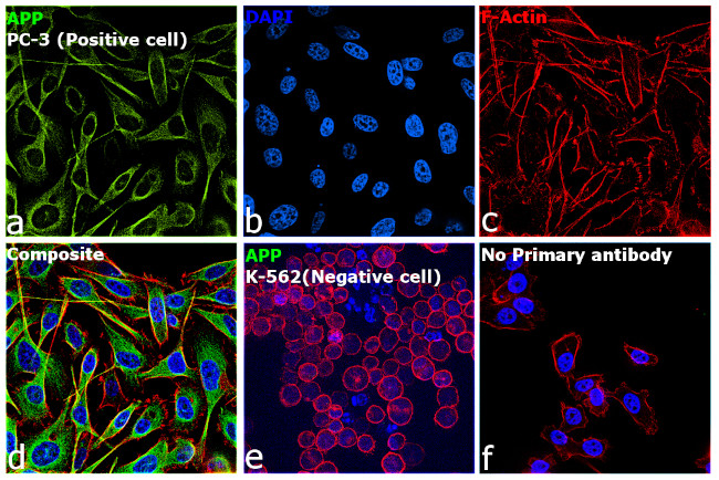 beta Amyloid Antibody in Immunocytochemistry (ICC/IF)