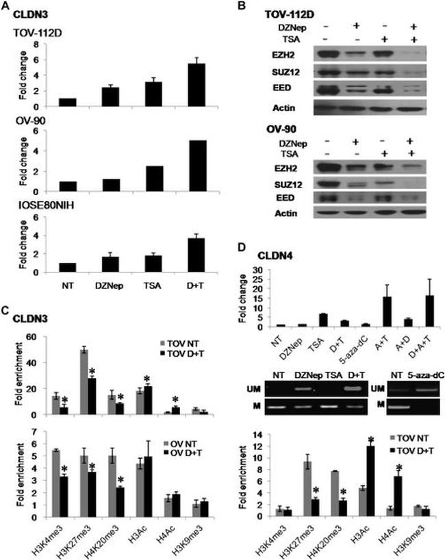 EZH2 Antibody in Western Blot (WB)