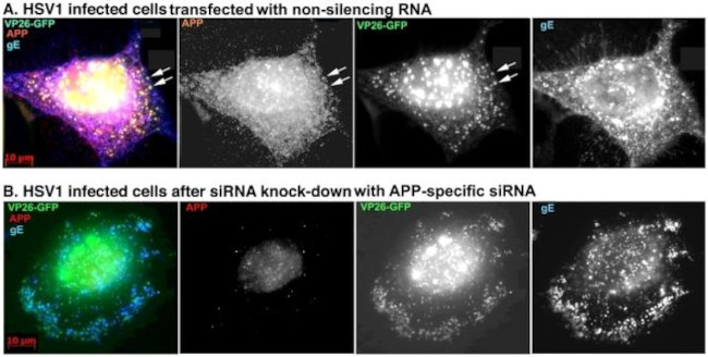 beta Amyloid Antibody in Immunocytochemistry (ICC/IF)