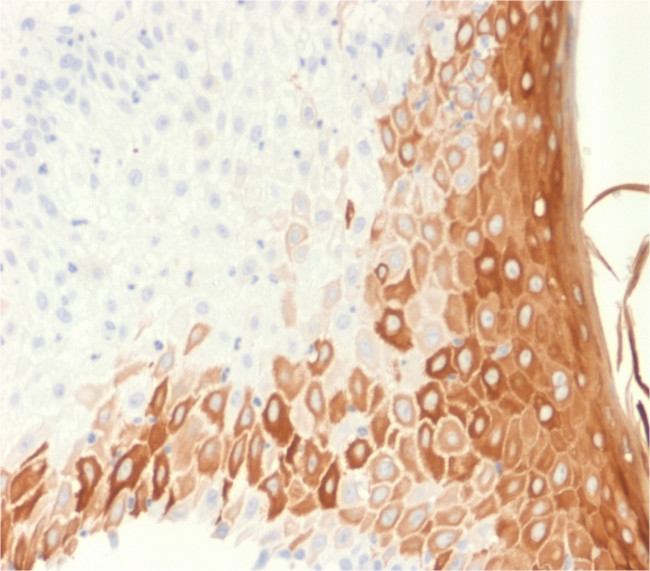 Cytokeratin 10 Antibody in Immunohistochemistry (Paraffin) (IHC (P))