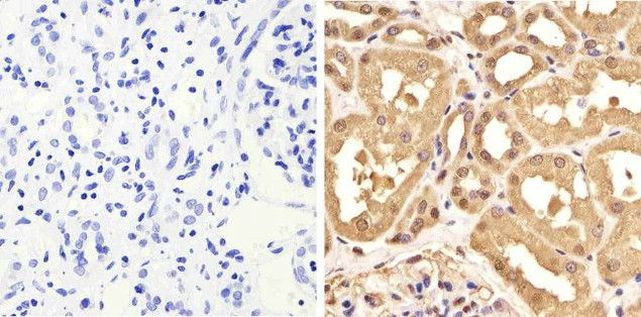 GAPDH Antibody in Immunohistochemistry (Paraffin) (IHC (P))