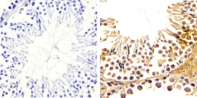 Metadherin Antibody in Immunohistochemistry (Paraffin) (IHC (P))