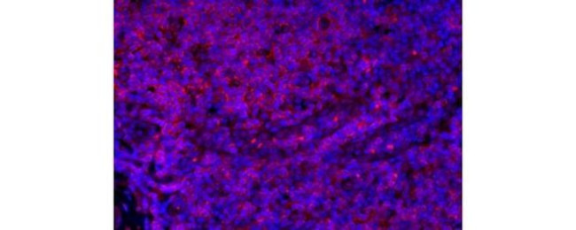 CD4 Antibody in Immunohistochemistry (Paraffin) (IHC (P))