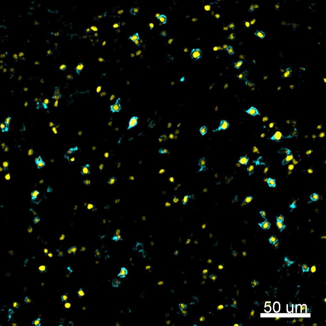 FOXP3 Antibody in Immunohistochemistry (IHC)