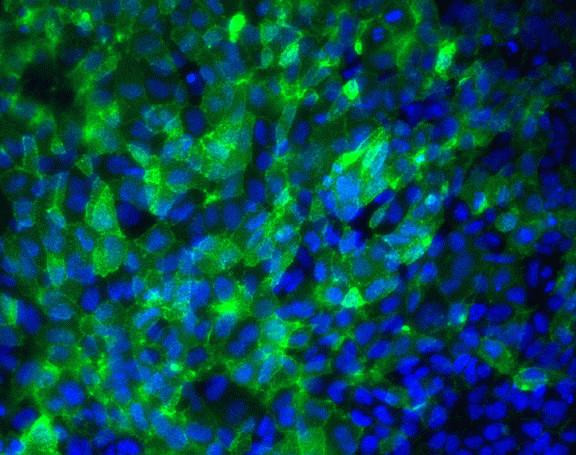 TRA-1-60 Antibody in Immunocytochemistry (ICC/IF)