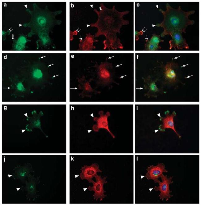 alpha Actinin 4 Antibody in Immunocytochemistry (ICC/IF)