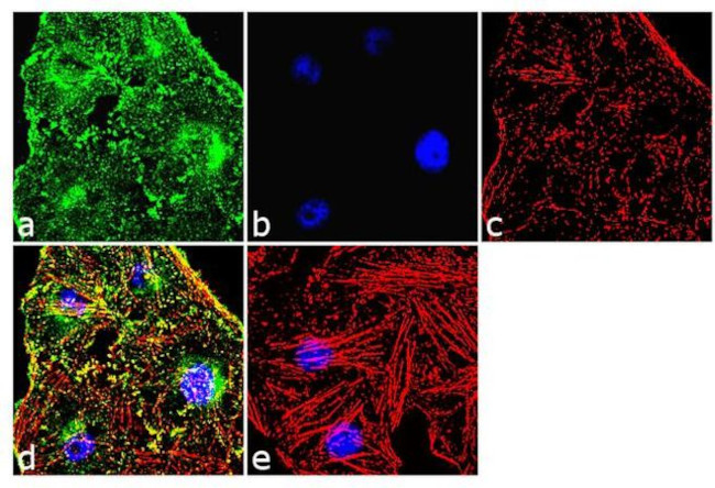 alpha Actinin 4 Antibody in Immunocytochemistry (ICC/IF)