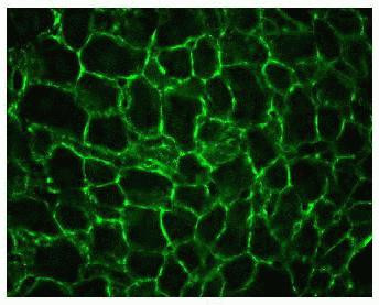 alpha Actinin 4 Antibody in Immunohistochemistry (IHC)