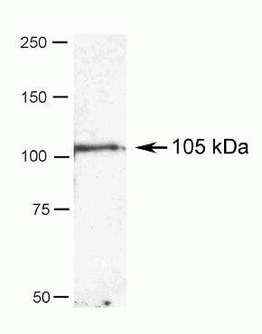 alpha Actinin 4 Antibody in Western Blot (WB)