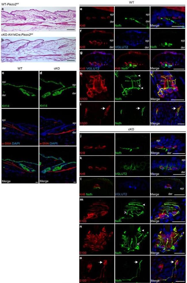 VGLUT2 Antibody in Immunocytochemistry (ICC/IF)