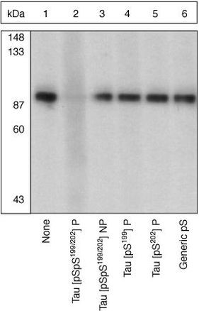 Phospho-Tau (Ser199, Ser202) Antibody