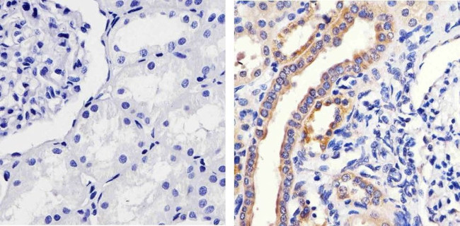 Phospho-MEK1 (Ser298) Antibody in Immunohistochemistry (Paraffin) (IHC (P))