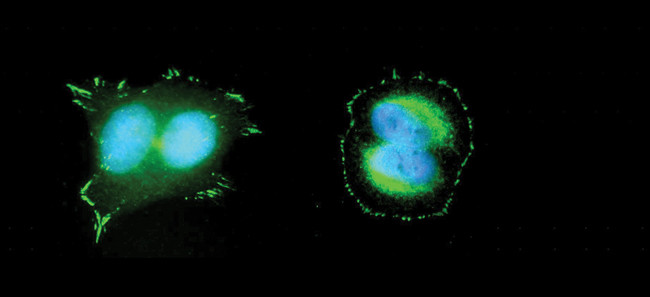 Phospho-FAK (Tyr397) Antibody in Immunocytochemistry (ICC/IF)