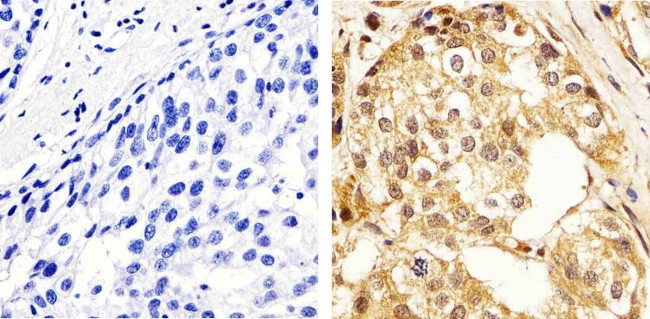 ERK1/ERK2 Antibody in Immunohistochemistry (Paraffin) (IHC (P))