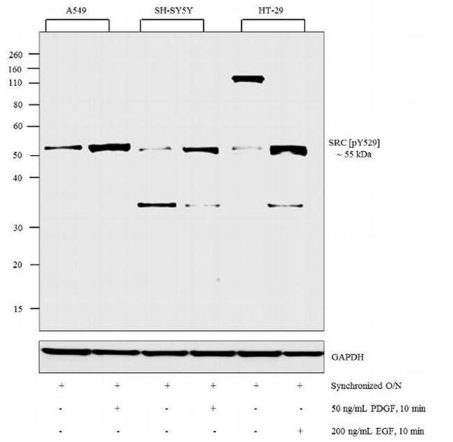 Phospho-SRC (Tyr529) Antibody in Western Blot (WB)