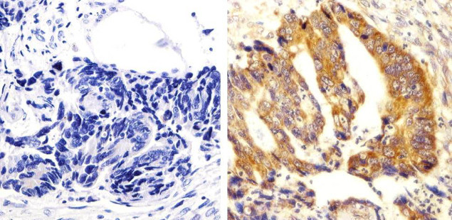 Phospho-SRC (Tyr529) Antibody in Immunohistochemistry (Paraffin) (IHC (P))