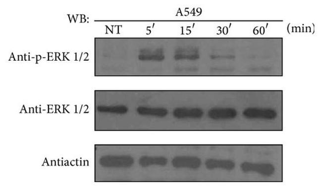 Phospho-ERK1/ERK2 (Thr185, Tyr187) Antibody in Western Blot (WB)