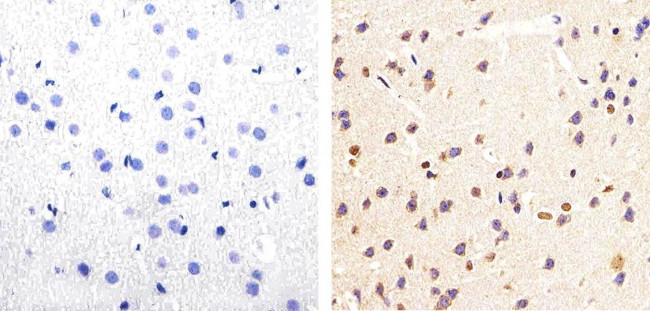 Phospho-Tau (Ser199, Ser202) Antibody in Immunohistochemistry (Paraffin) (IHC (P))