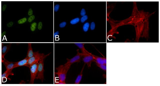 Phospho-Tau (Ser199, Ser202) Antibody in Immunocytochemistry (ICC/IF)