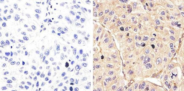 Phospho-EGFR (Tyr992) Antibody in Immunohistochemistry (Paraffin) (IHC (P))