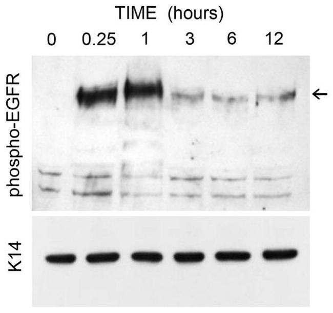 Phospho-EGFR (Tyr1068) Antibody in Western Blot (WB)