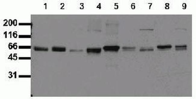 SHC Antibody in Western Blot (WB)