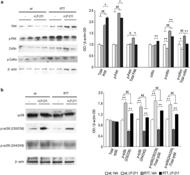 Phospho-PAK1/2/3 (Ser141) Antibody in Western Blot (WB)