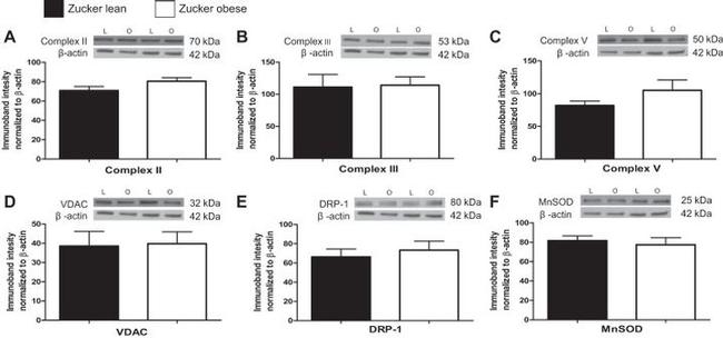 ATP5A1 Antibody in Western Blot (WB)