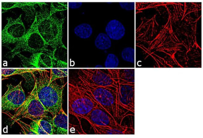 beta Tubulin Antibody in Immunocytochemistry (ICC/IF)