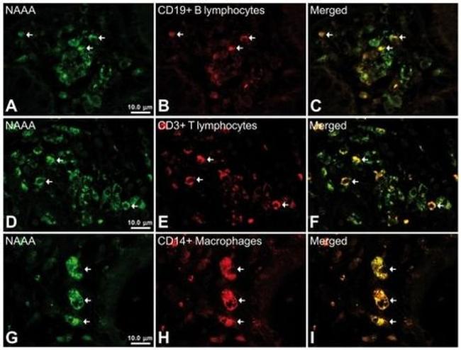 CD3 Antibody in Immunohistochemistry (IHC)