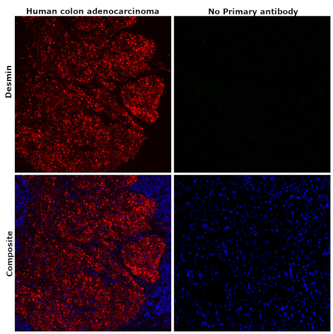 Desmin Antibody in Immunohistochemistry (Paraffin) (IHC (P))