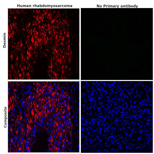 Desmin Antibody in Immunohistochemistry (Paraffin) (IHC (P))