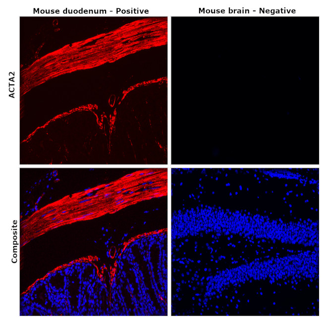 Desmin Antibody in Immunohistochemistry (Paraffin) (IHC (P))