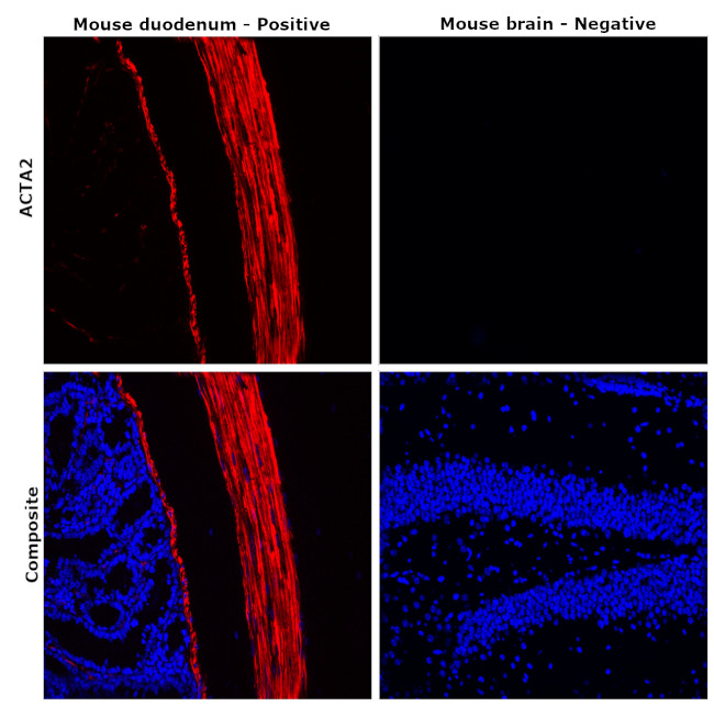 Desmin Antibody in Immunohistochemistry (Paraffin) (IHC (P))