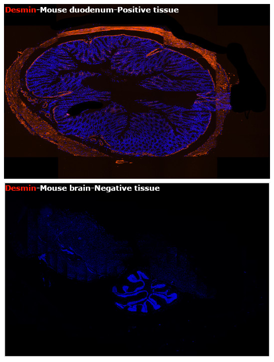 Desmin Antibody in Immunohistochemistry (Paraffin) (IHC (P))