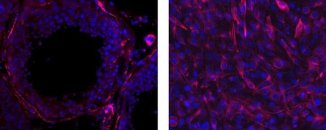 Desmin Antibody in Immunohistochemistry (Paraffin) (IHC (P))