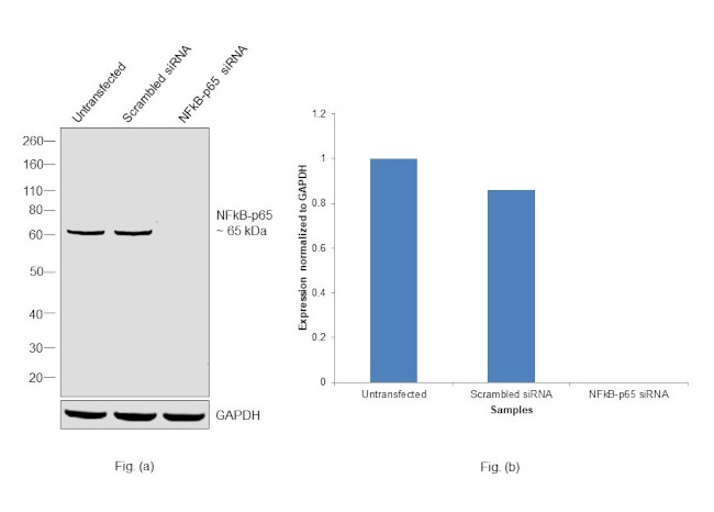 NFkB p65 Antibody