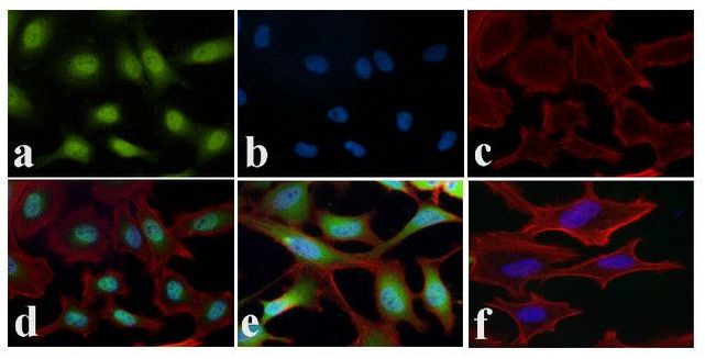 NFkB p65 Antibody in Immunocytochemistry (ICC/IF)