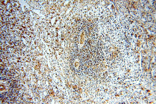 STAT6 Antibody in Immunohistochemistry (Paraffin) (IHC (P))