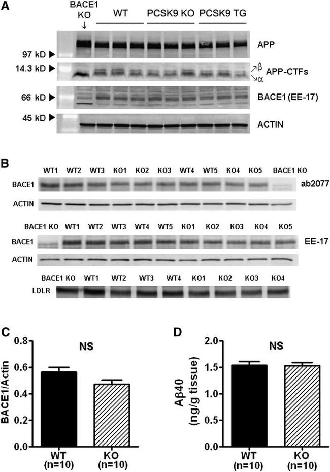 beta Amyloid Antibody in Western Blot (WB)