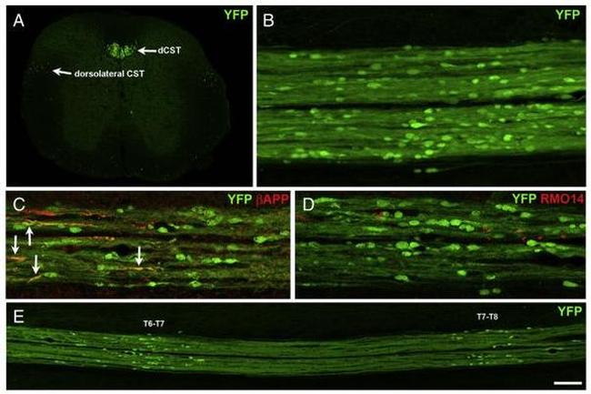 beta Amyloid Antibody in Immunohistochemistry (IHC)