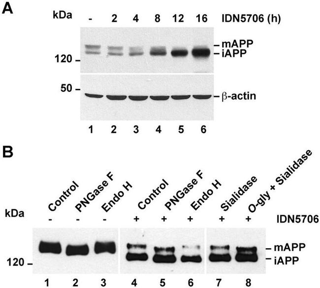 beta Amyloid Antibody in Western Blot (WB)